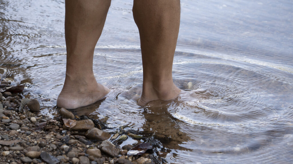 Do Not Walk Barefoot if You Have Diabetes