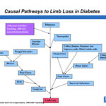 Causal Pathways to Limb Loss Diabetes