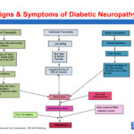 Signs & Symptoms of Diabetic Neuropathy